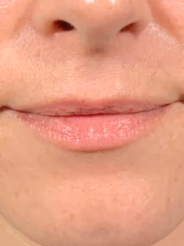 SIERRA_LIPS_VOLBELLA