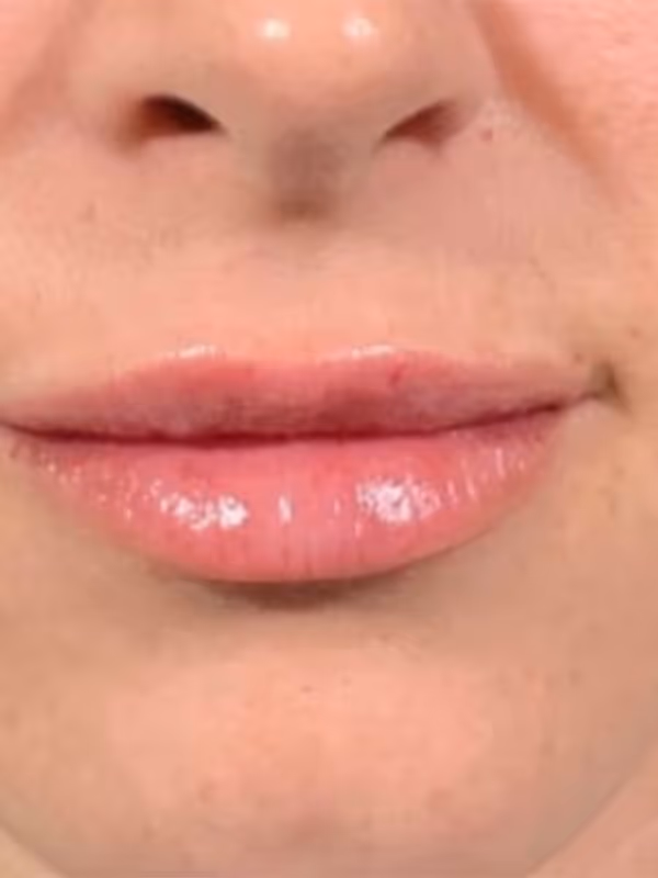 SIERRA_LIPS_VOLBELLA