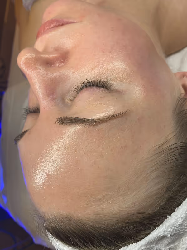 JESS_HYDRAFACIAL