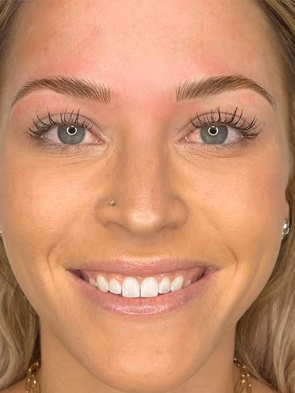 CAMILLE_MICROBLADING