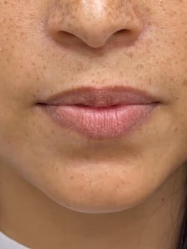 ALIX_LIPS_RESTYLANEKYSSE