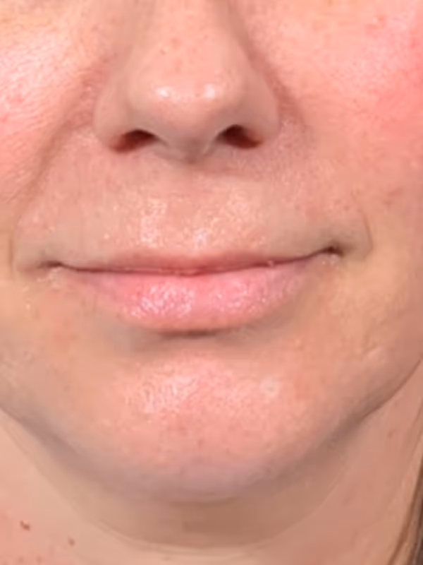 SIERRA_LIPS_VOLBELLA