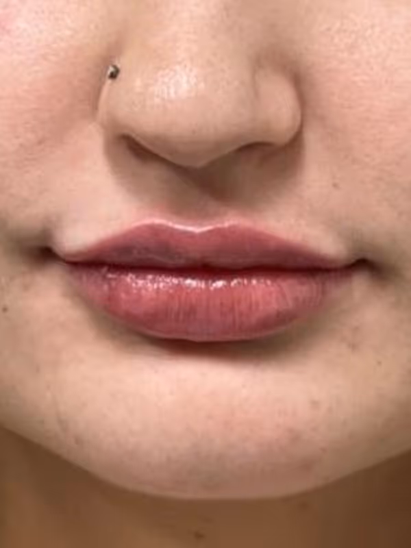 SIERRA_LIPS