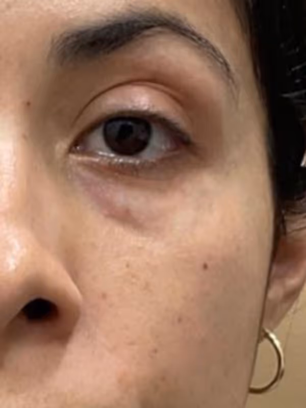 JOJO_TEARTROUGHFILLER