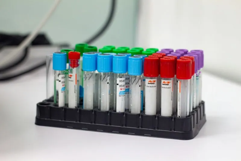 DUTCH hormone test samples with labeled collection tubes in a laboratory setting for hormone analysis