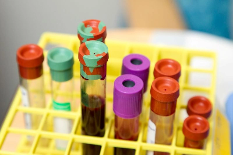 Laboratory blood sample tubes used for IBS testing and digestive health analysis