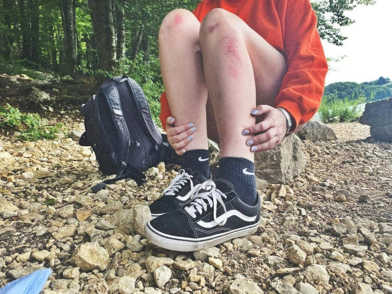 Person sitting outdoors with scraped knees and holding their legs, experiencing a possible prickling sensation around irritated skin