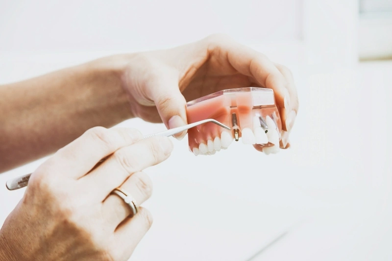 Dentist demonstrating dental implants and materials on a teeth model, highlighting the importance of dental allergy testing