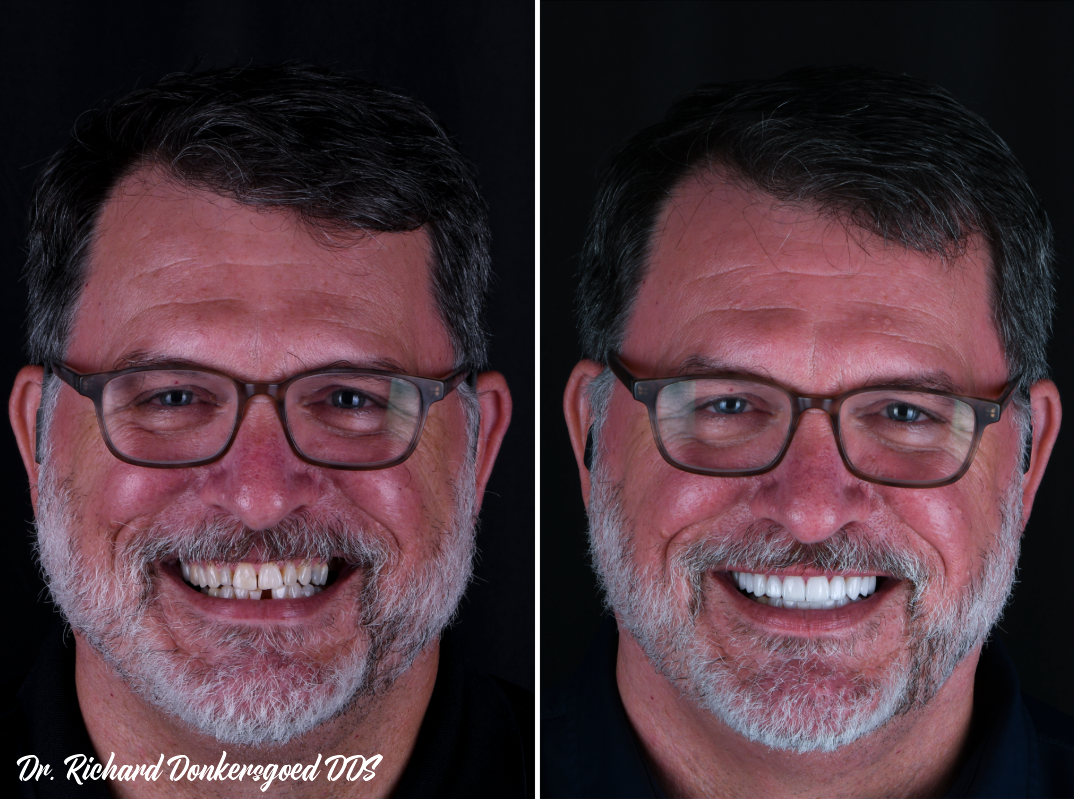 Jacob before and after