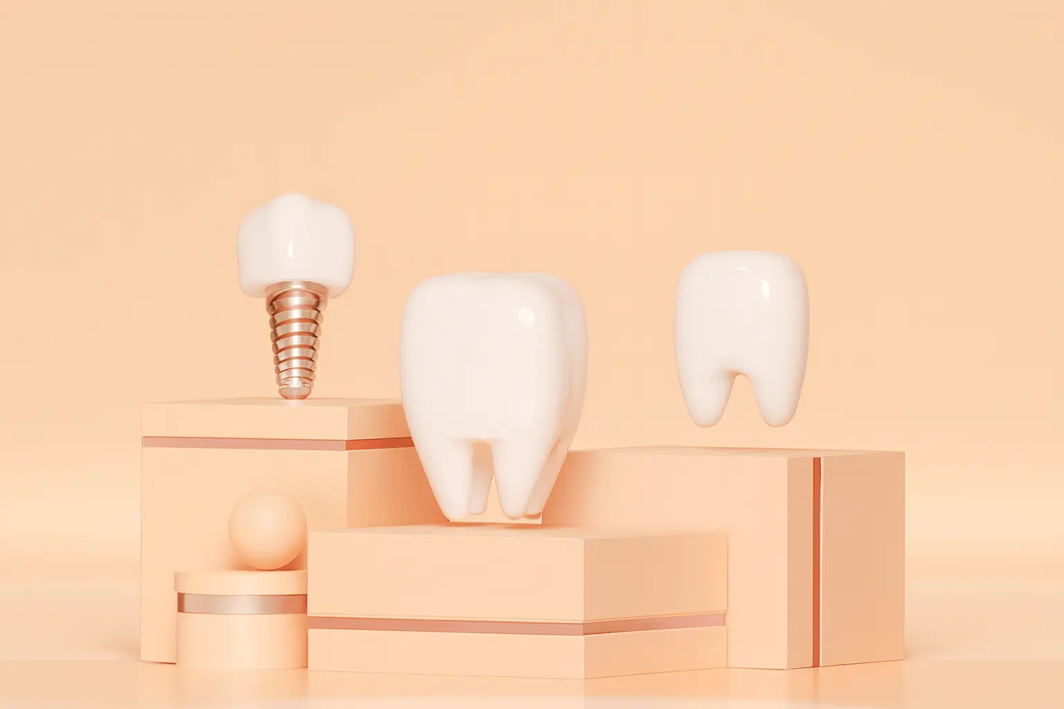 Dental Implant Cost in the UK