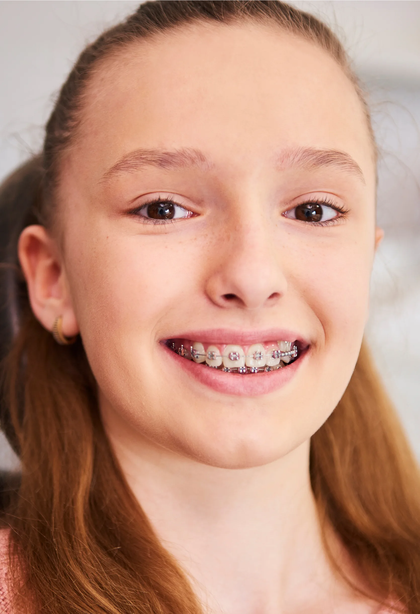 Braces for Kids and Teens: We Help Your Child Achieve a Confident Smile