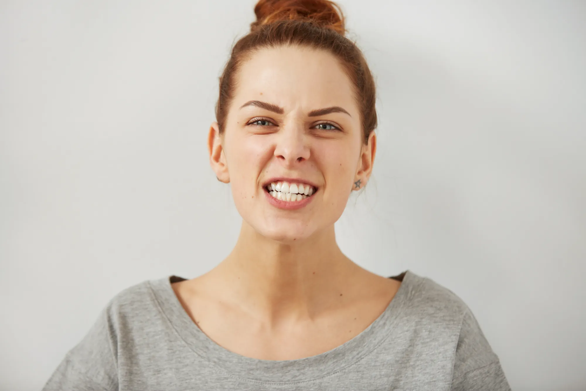 Why Should You Fix an Overbite?