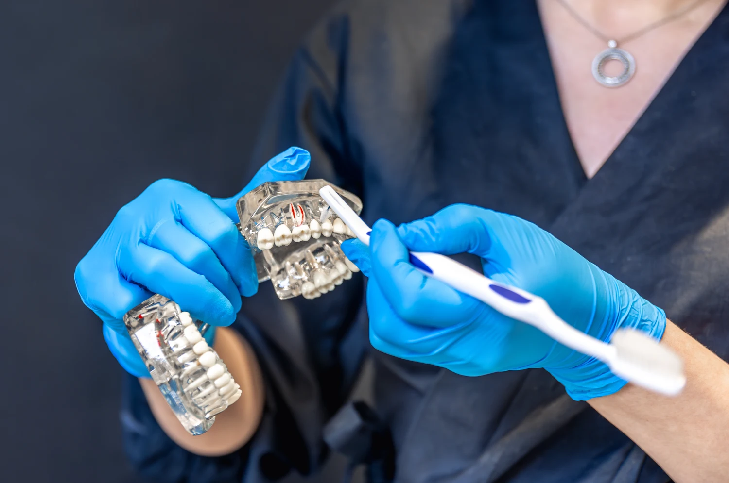 How Do Dental Implants Work and What to Expect?