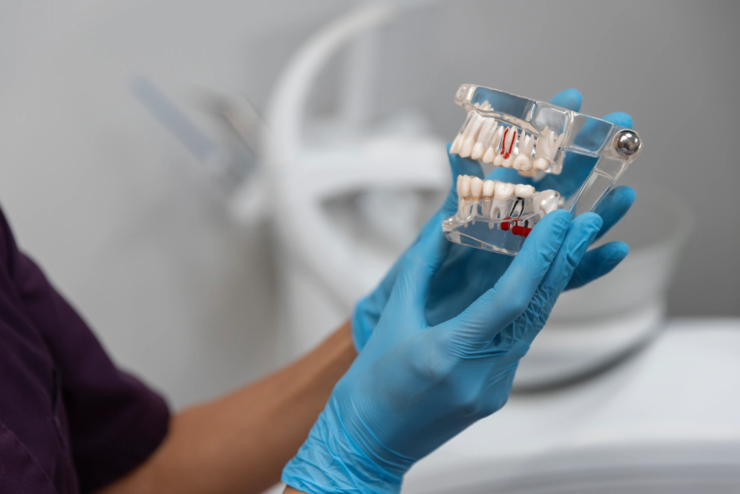 How Do Dental Implants Work?