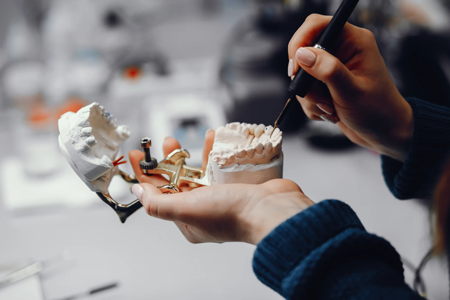 Why Dental Implants Fail or Need Replacement