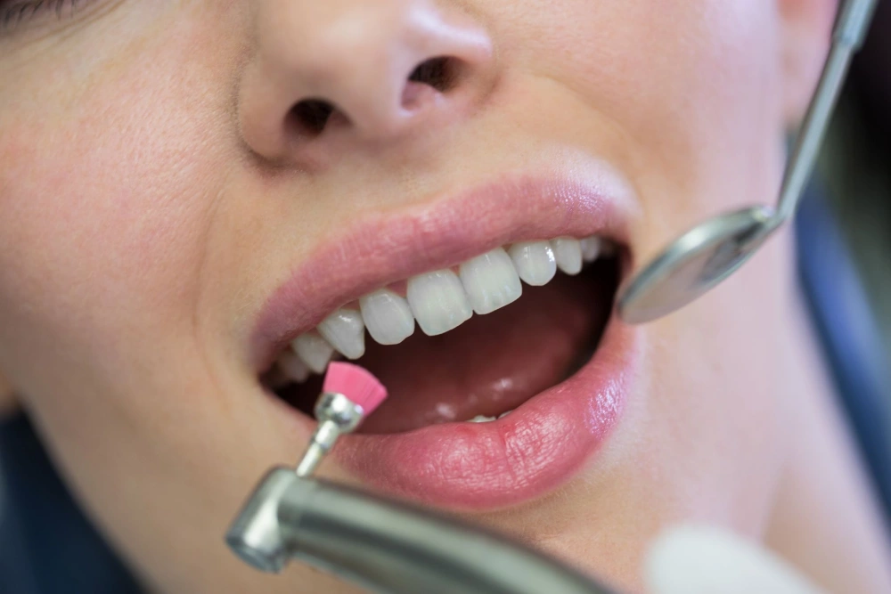 How Often Can You Whiten Your Teeth Safely?