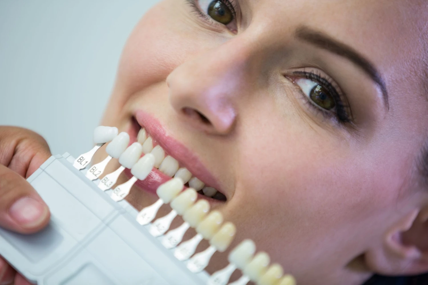 How to Make Composite Bonding Last Longer