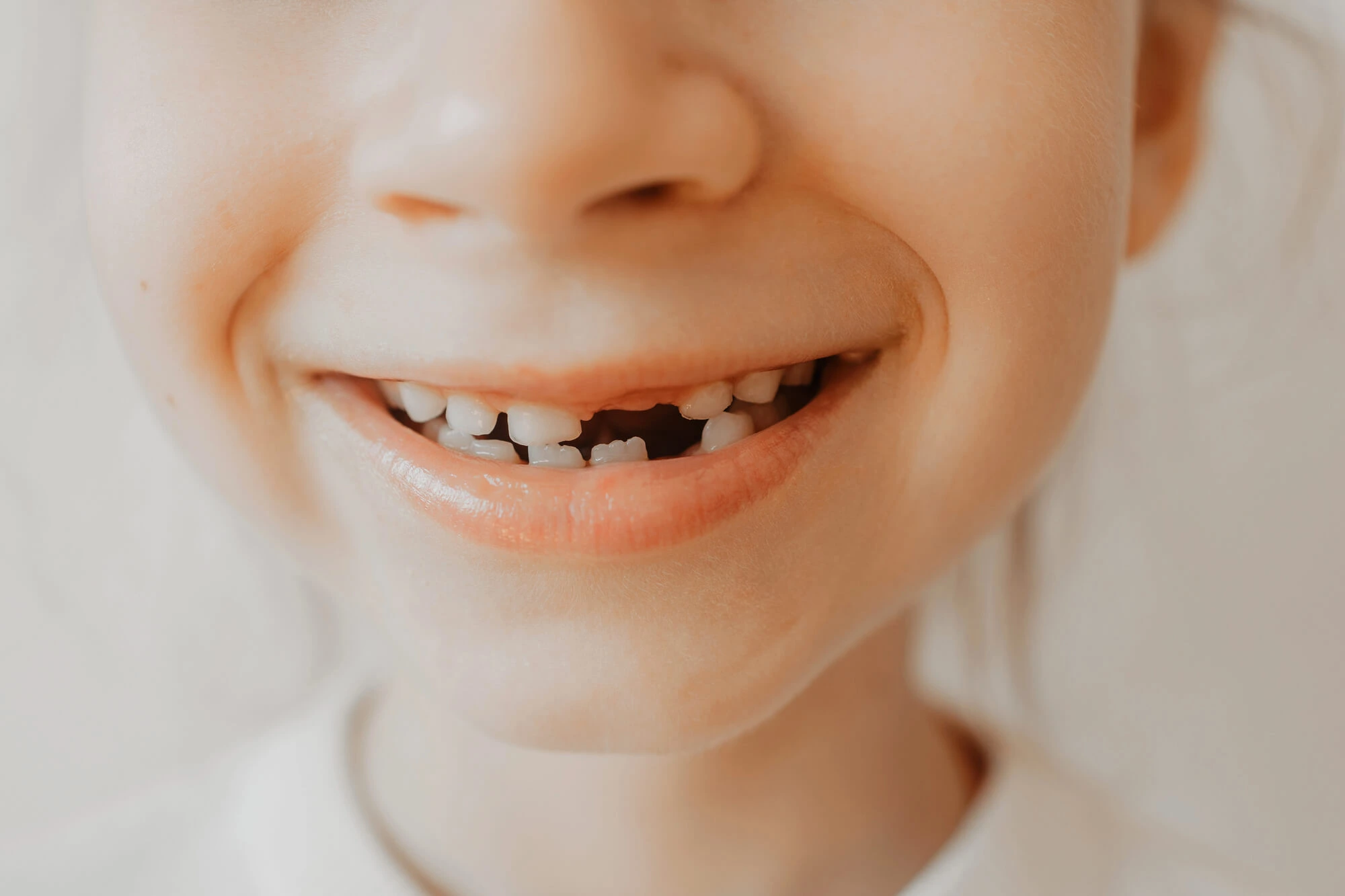 Family Dentist in Morton IL That Treats Missing Permanent Teeth