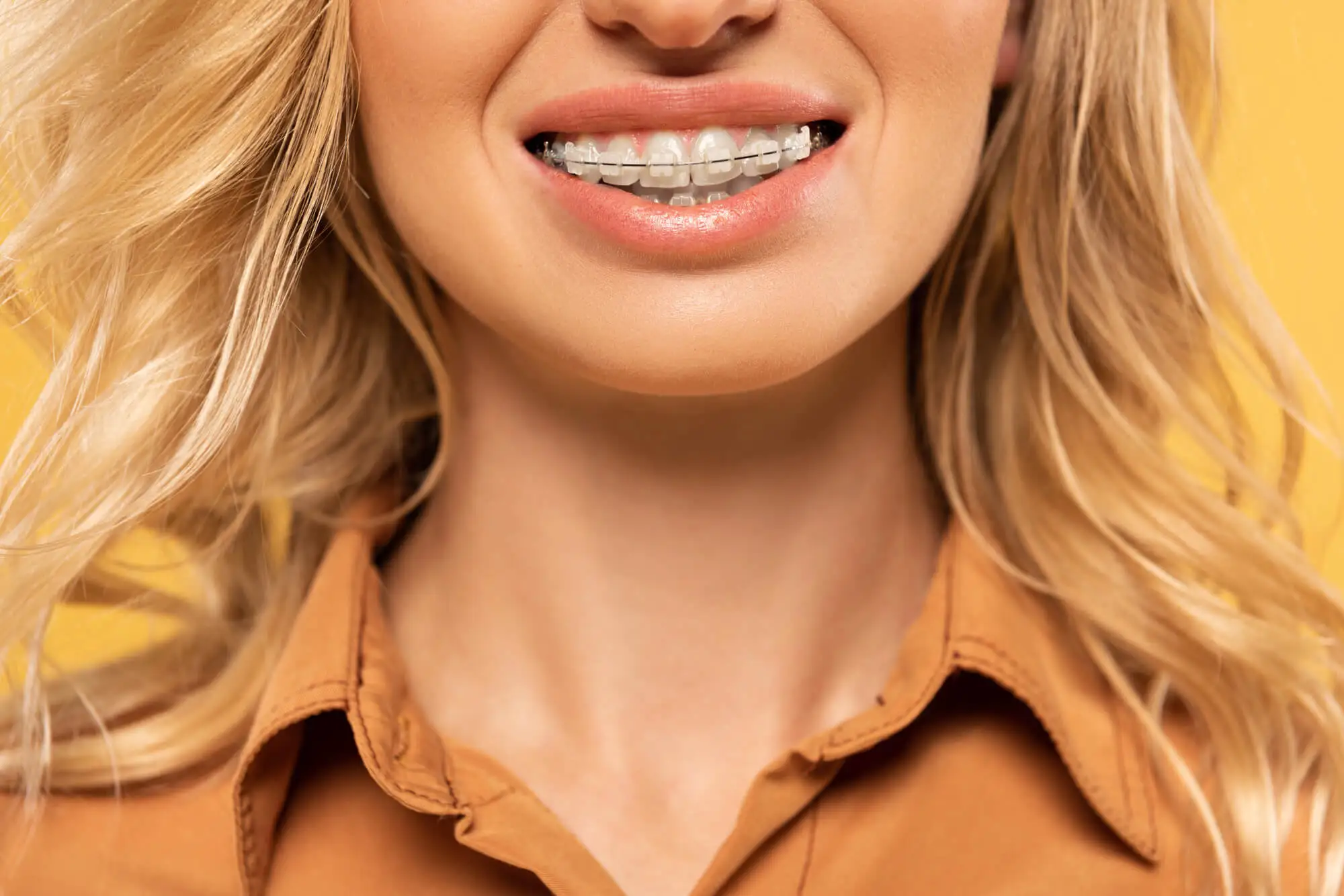 Is There an Age Limit to Orthodontics?