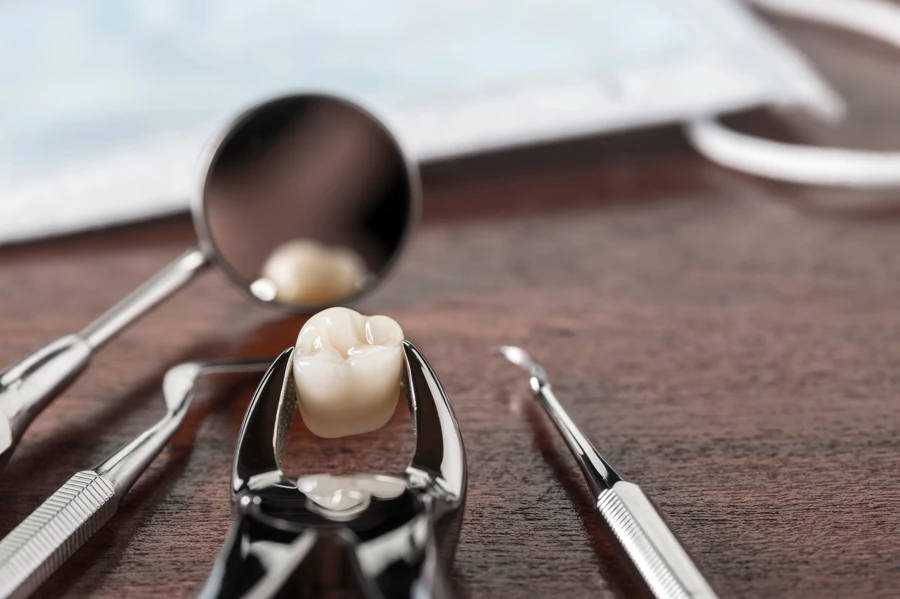 Can Wisdom Teeth Removal Affect Your Bite or Jaw Alignment?