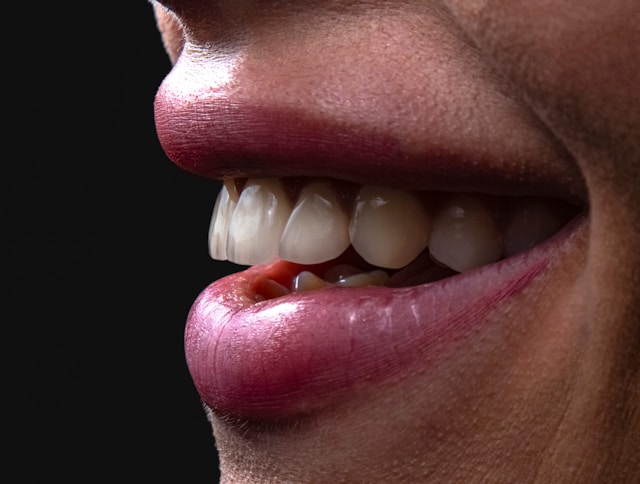 CandidPro Clear Aligners at West Vancouver Dental