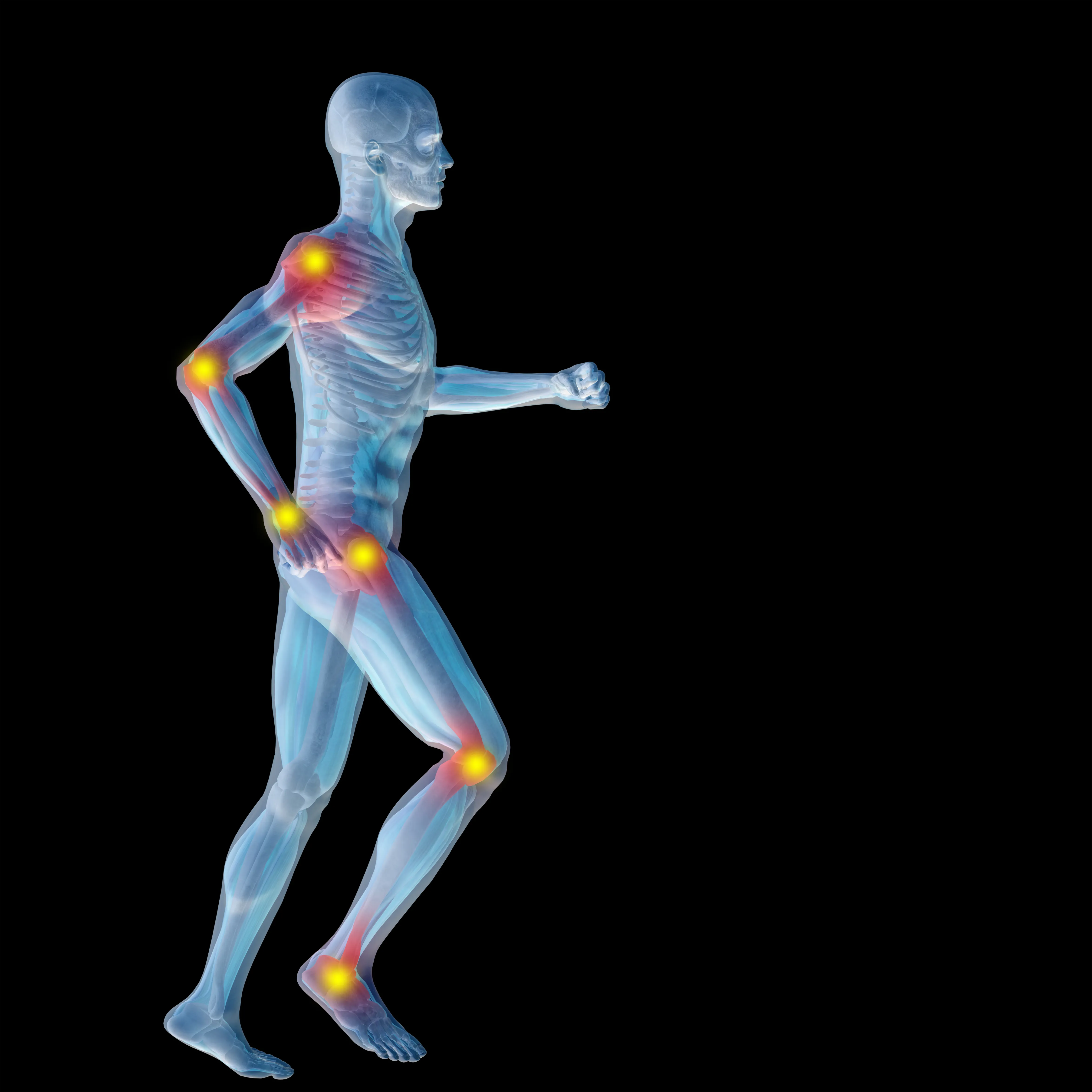 הזרקת חומצה היאלורונית