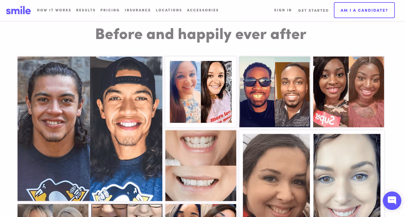 Smile Direct Club results page