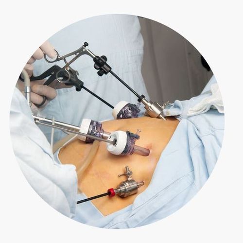 Bariatric Surgery NZ