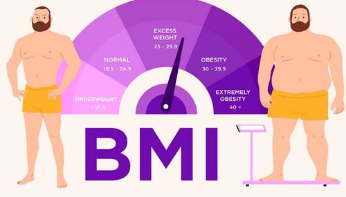 weight loss surgery nz