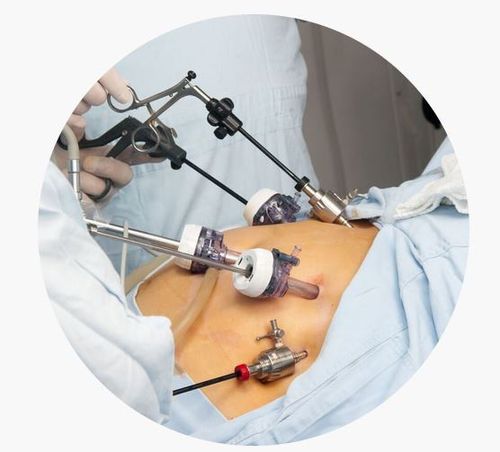 bariatric surgeon tauranga