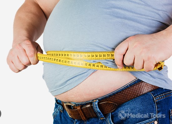 bariatric surgery nz