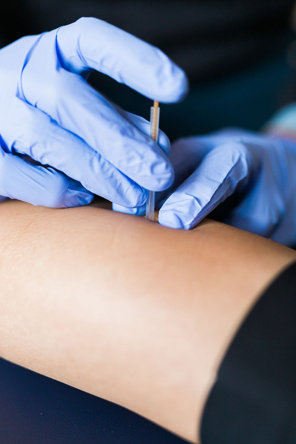 Undefeeted Podiatry — dry needling treatment