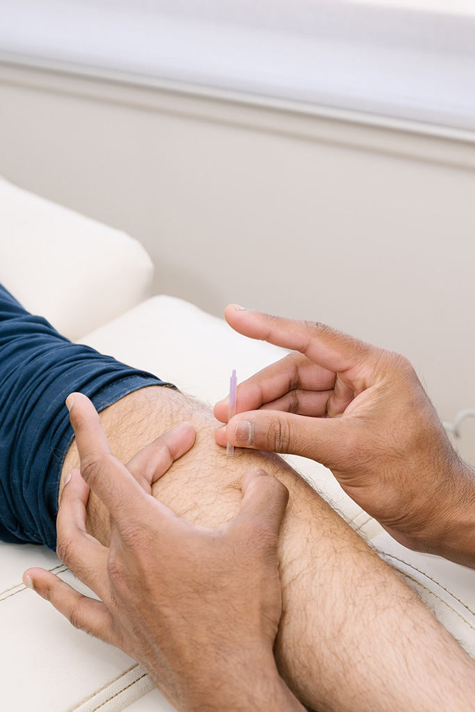 Undefeeted Podiatry — dry needling for calf and heel pain