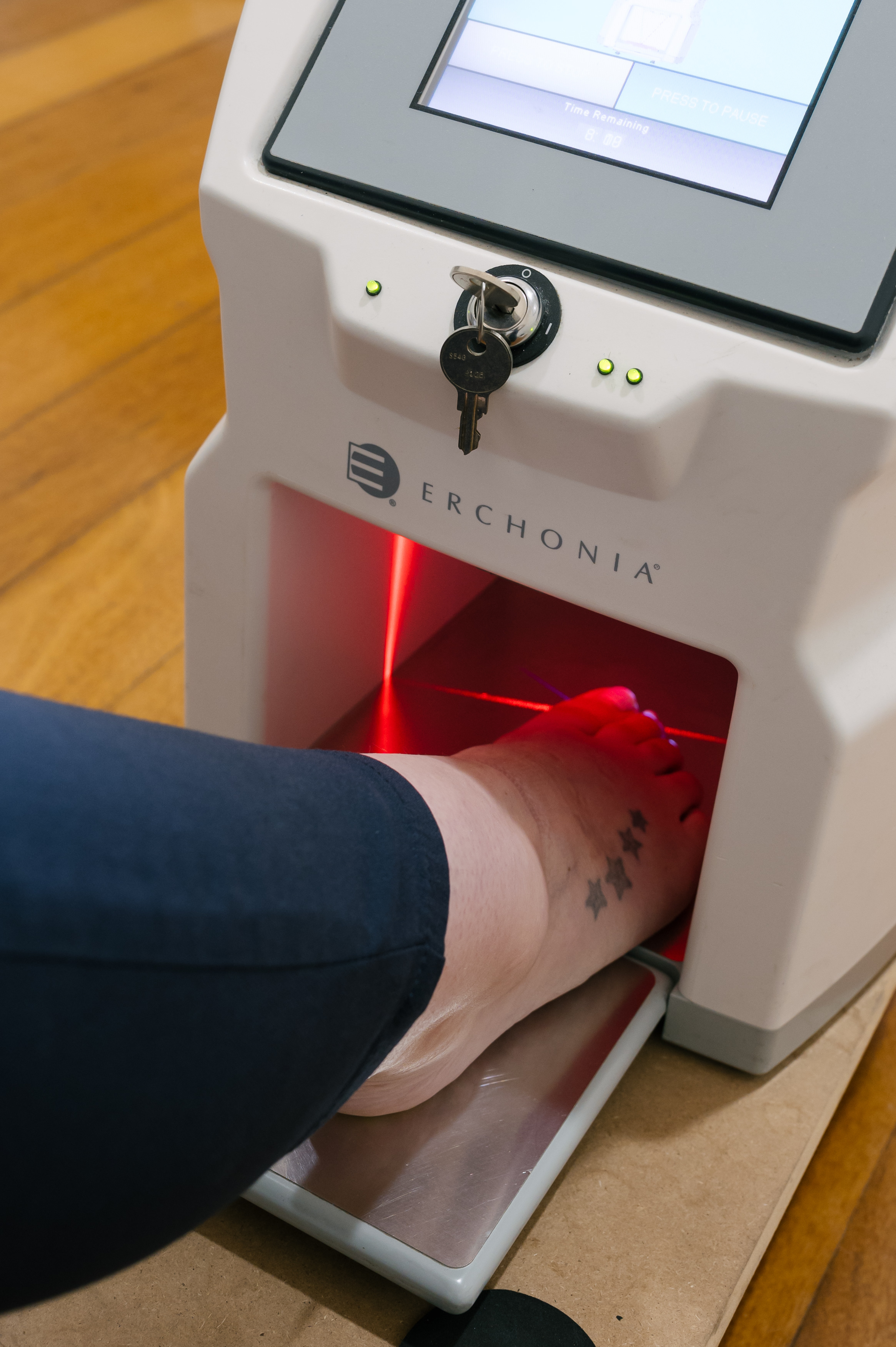 Lunula Laser equipment