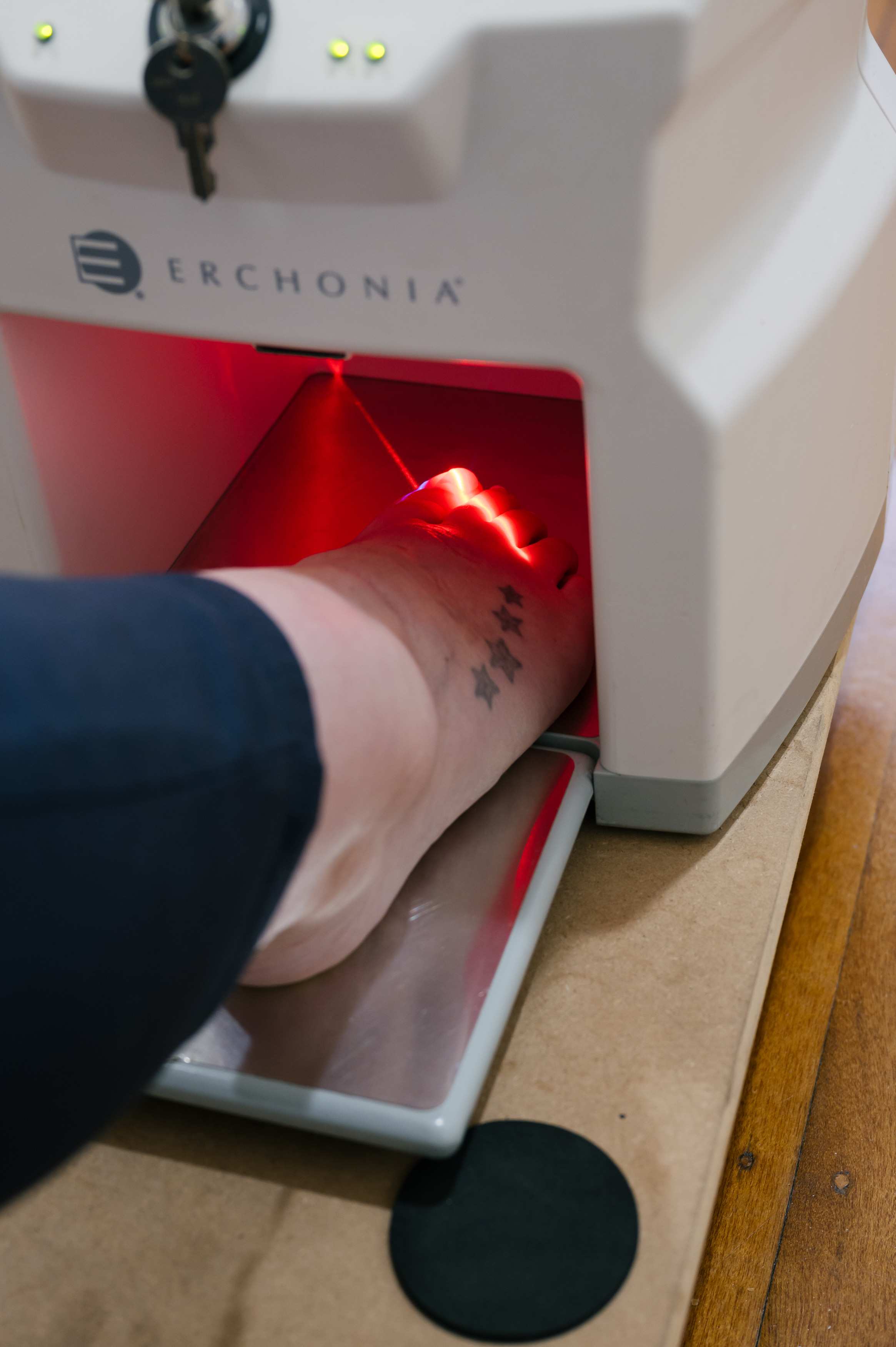 Lunula Laser device in use