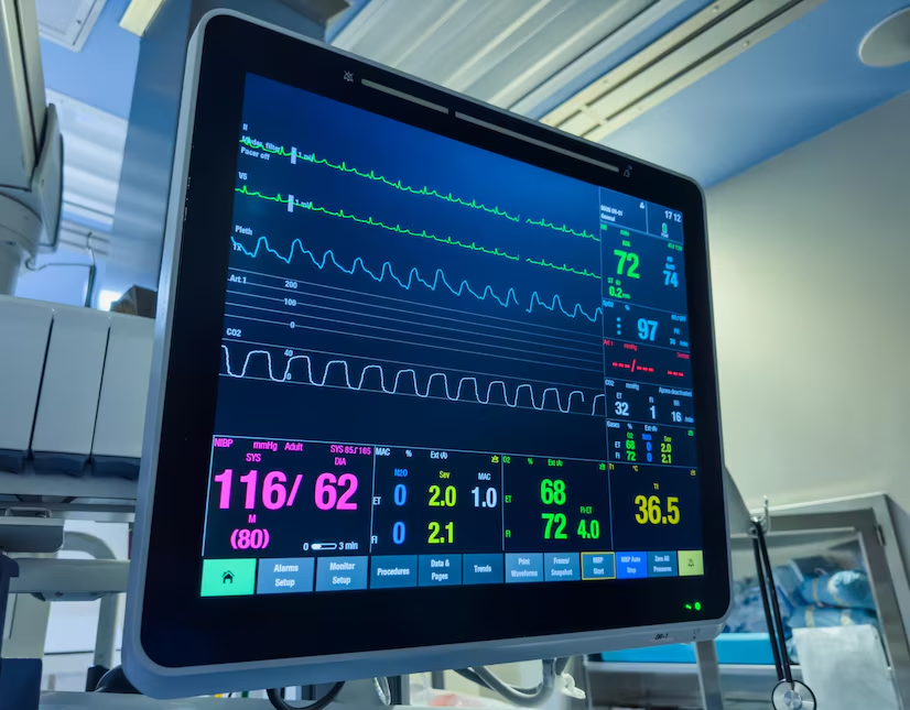 Optimiser sa gestion de l'arrêt cardio-respiratoire au bloc opératoire - P30
