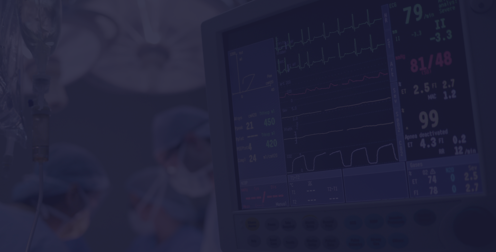 image article de blog safeteam