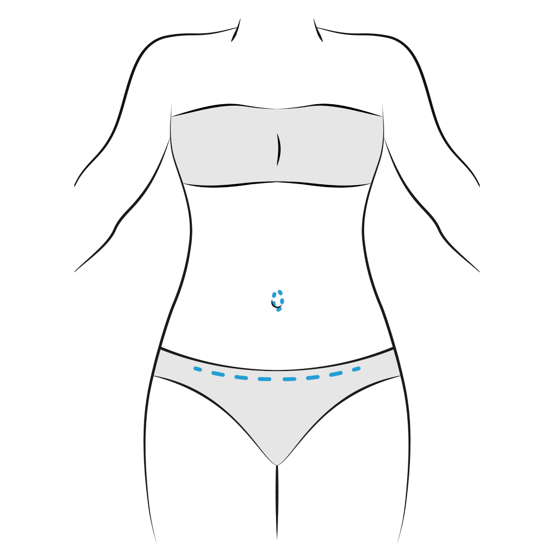 Who Is a Good Candidate for a Tummy Tuck?