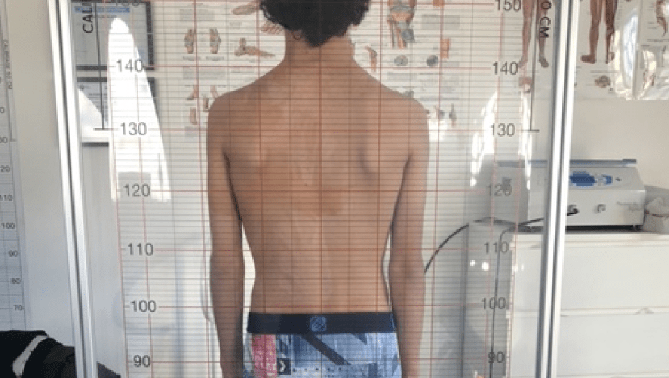 Photo d'un bilan postural