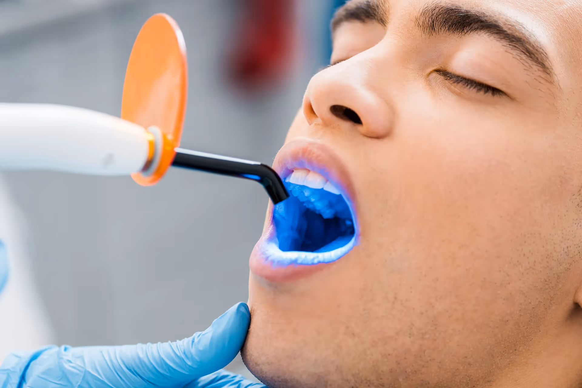Dental Sealants in Denver, CO