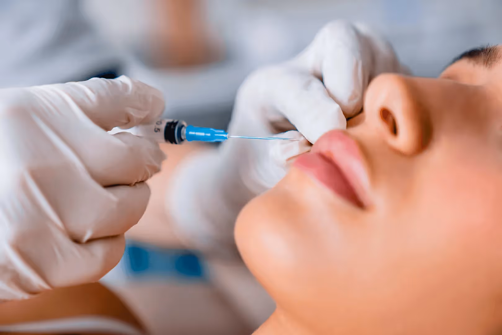 What Are Dermal Fillers?