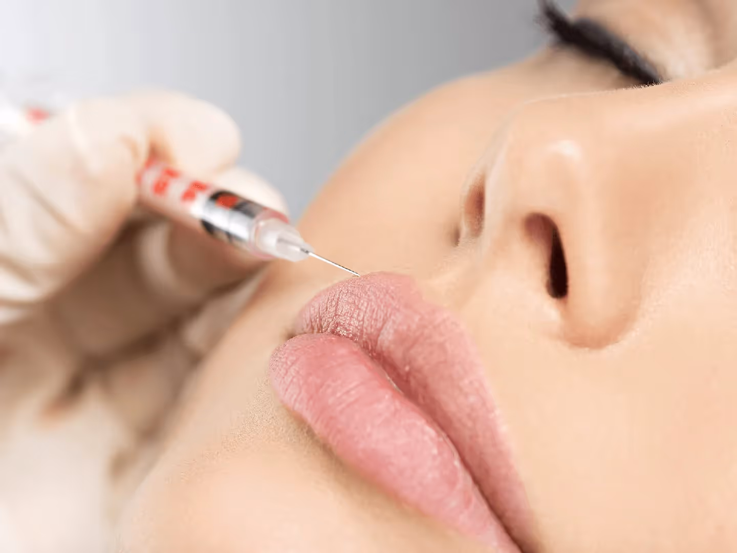 Dermal Fillers Denver CO