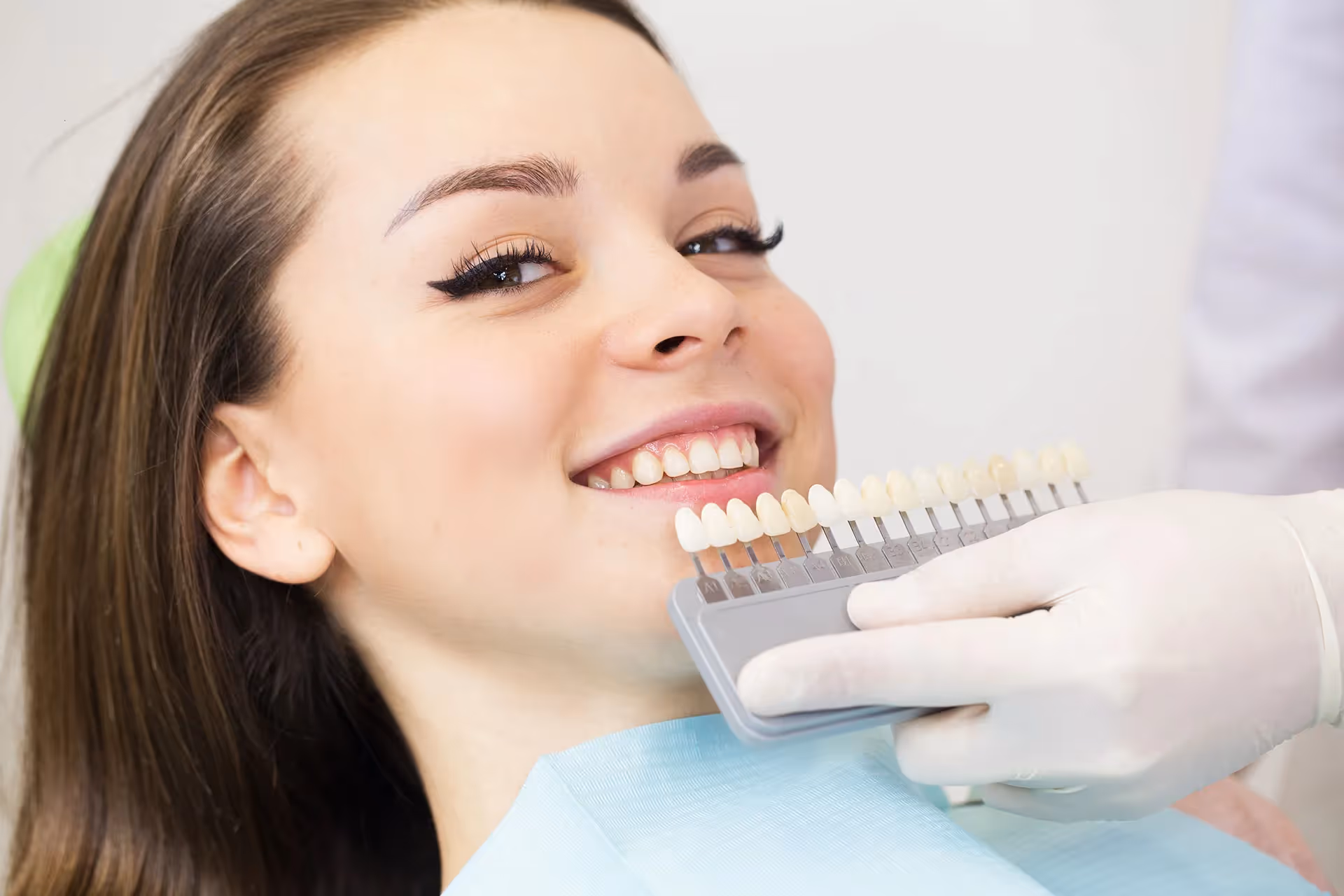 What are Porcelain Veneers?