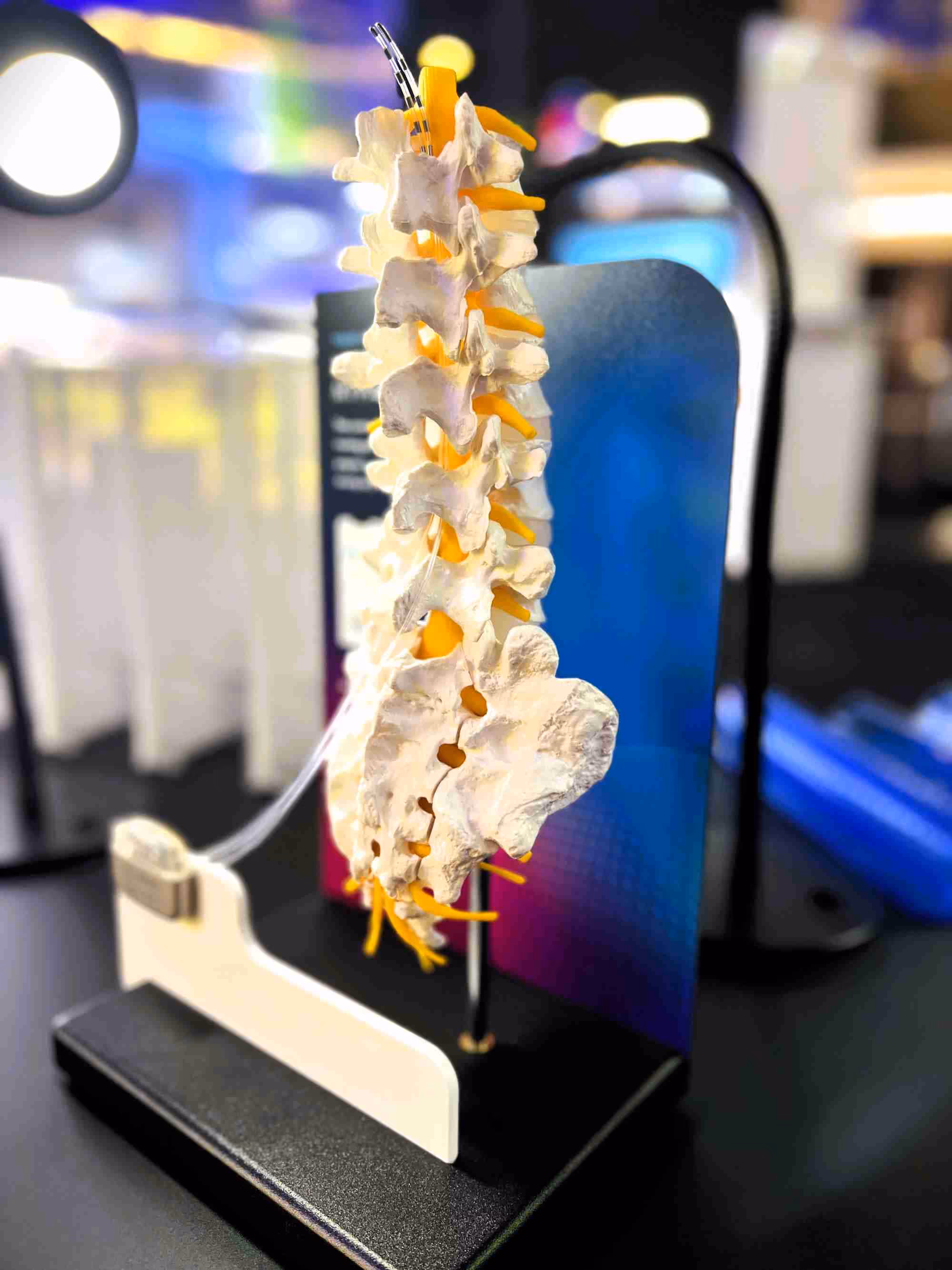 Custom medical device display of a human spine on a custom acrylic fixture