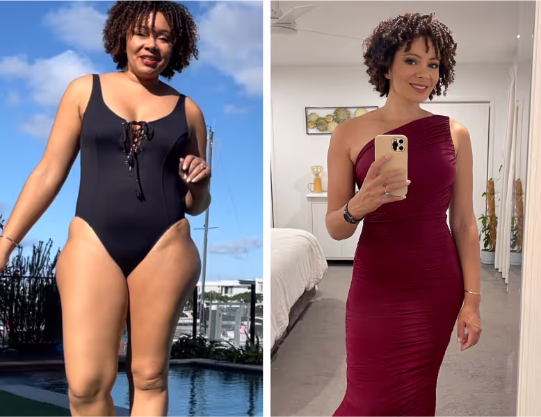 Pilot patient before weight loss treatment