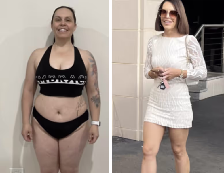 Pilot patient before weight loss treatment