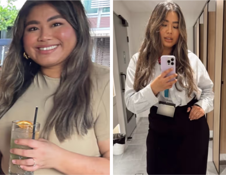 Pilot patient before weight loss treatment