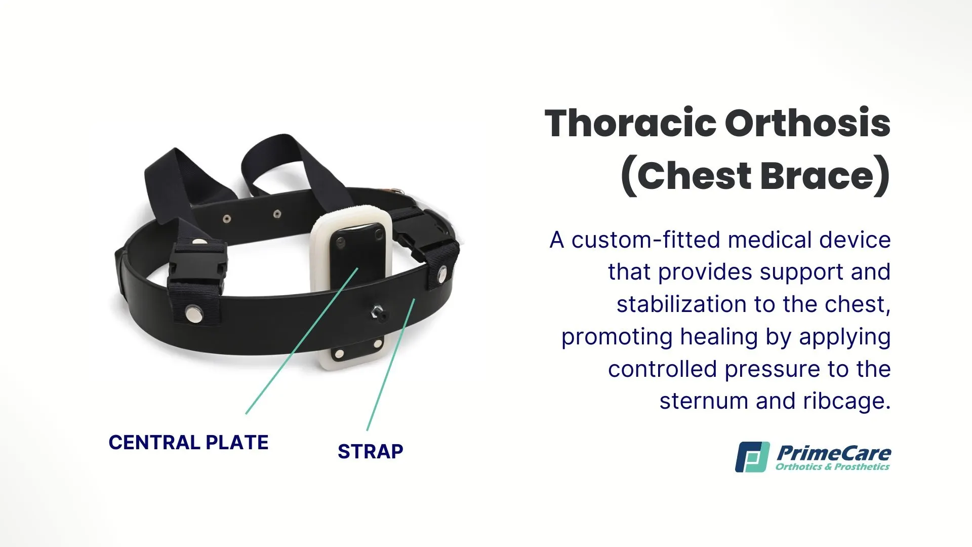 Thoracic Orthosis (Chest Brace)