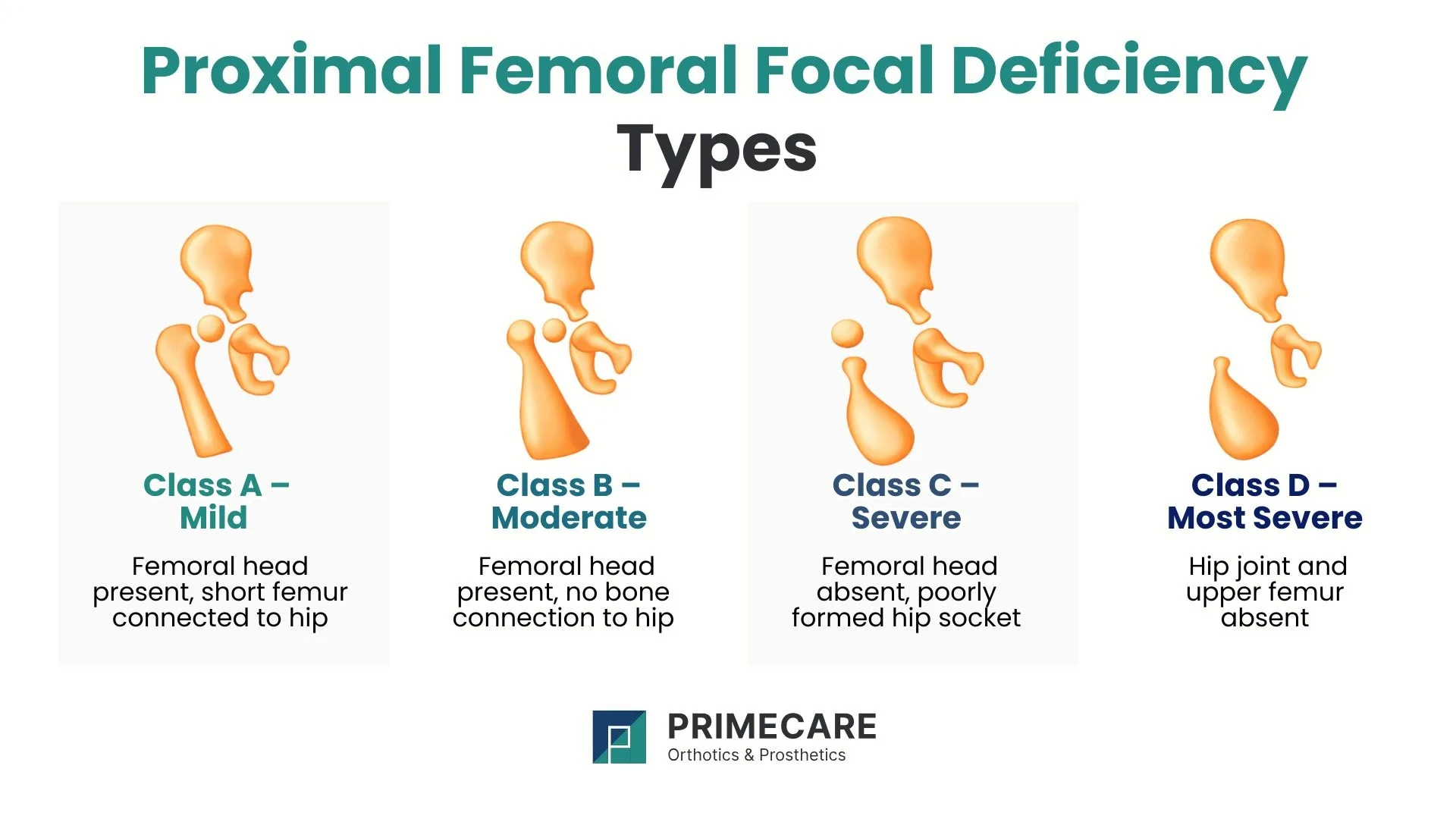  Proximal Femoral Focal Deficiency Types