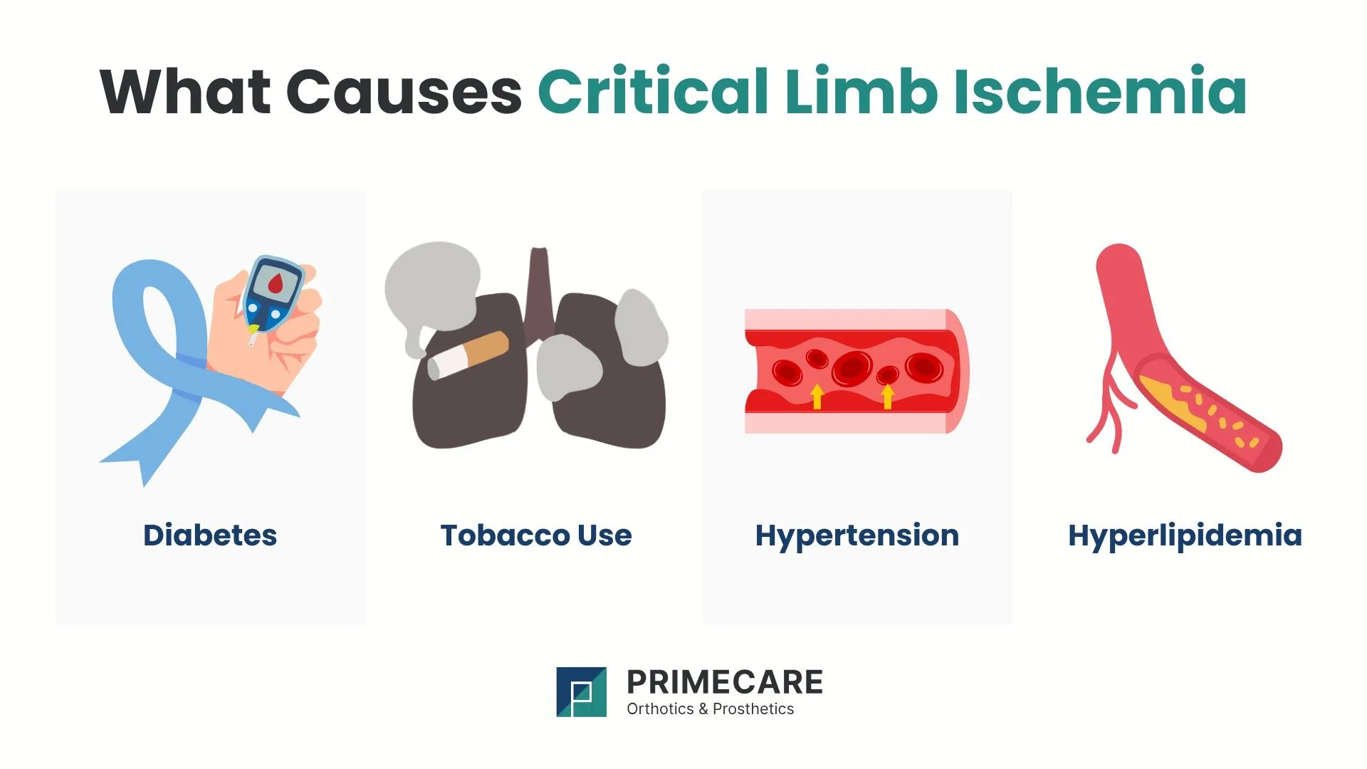 What Causes Critical Limb Ischemia